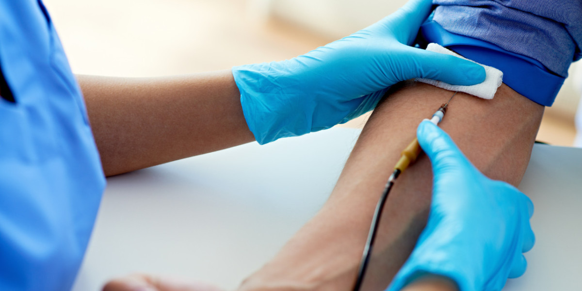 Comprehensive Guide to Blood Test in Bangalore - Benefits, Types, and Tips