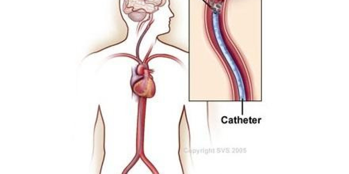 Benefits of the Thrombolysis Procedure