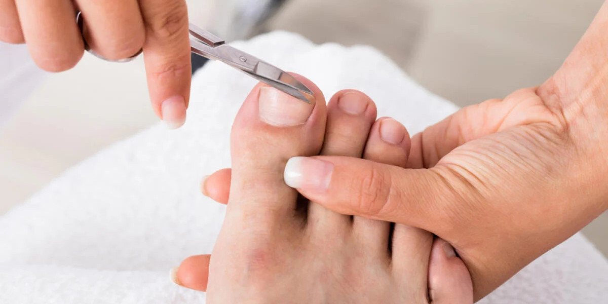 Nail Scissors for Ingrown Toenails: A Step-by-Step Guide NY