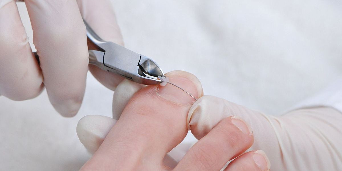 Affordable Ingrown Nail Scissors for Nail Care Enthusiasts