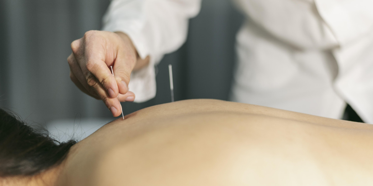 Discover the Healing Benefits of Acupuncture at Hannah Integrative Health in Newport Beach