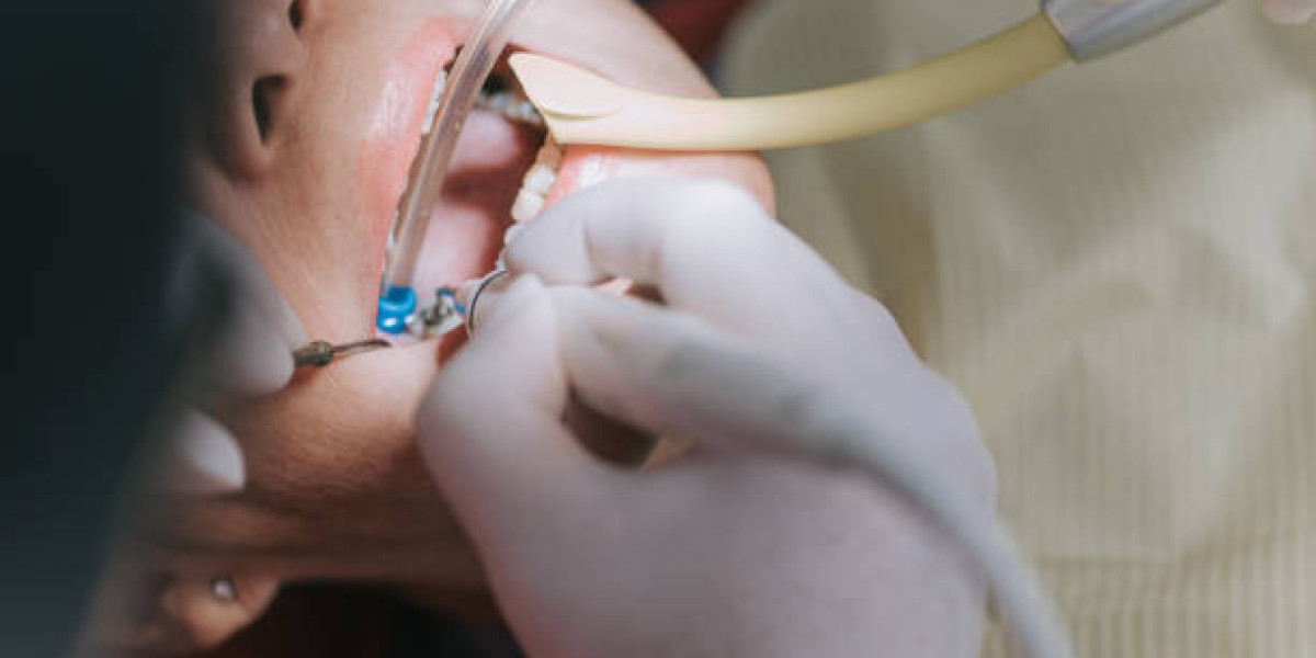 5 Signs You Need to Visit Trust Care Dental Immediately