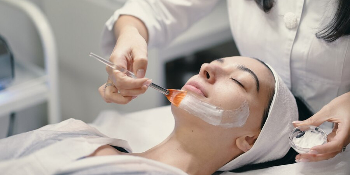 Discover the Benefits of Chemical Peels in Tucson: Your Guide to Glowing Skin