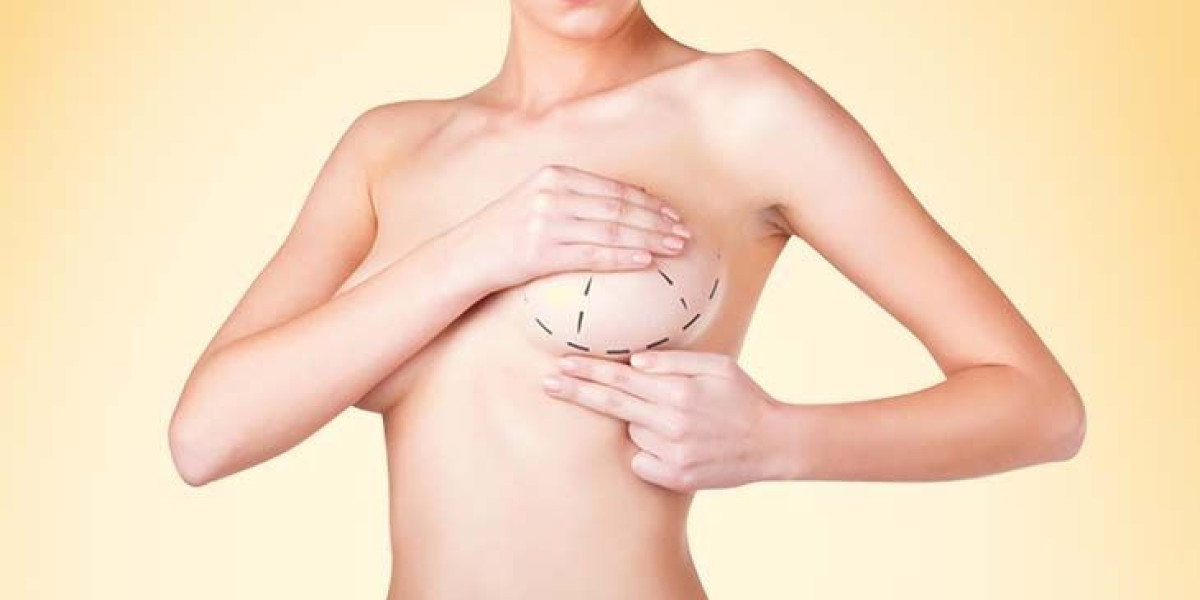 Breast Reduction Surgery in Dubai - Achieve Comfort and Confidence