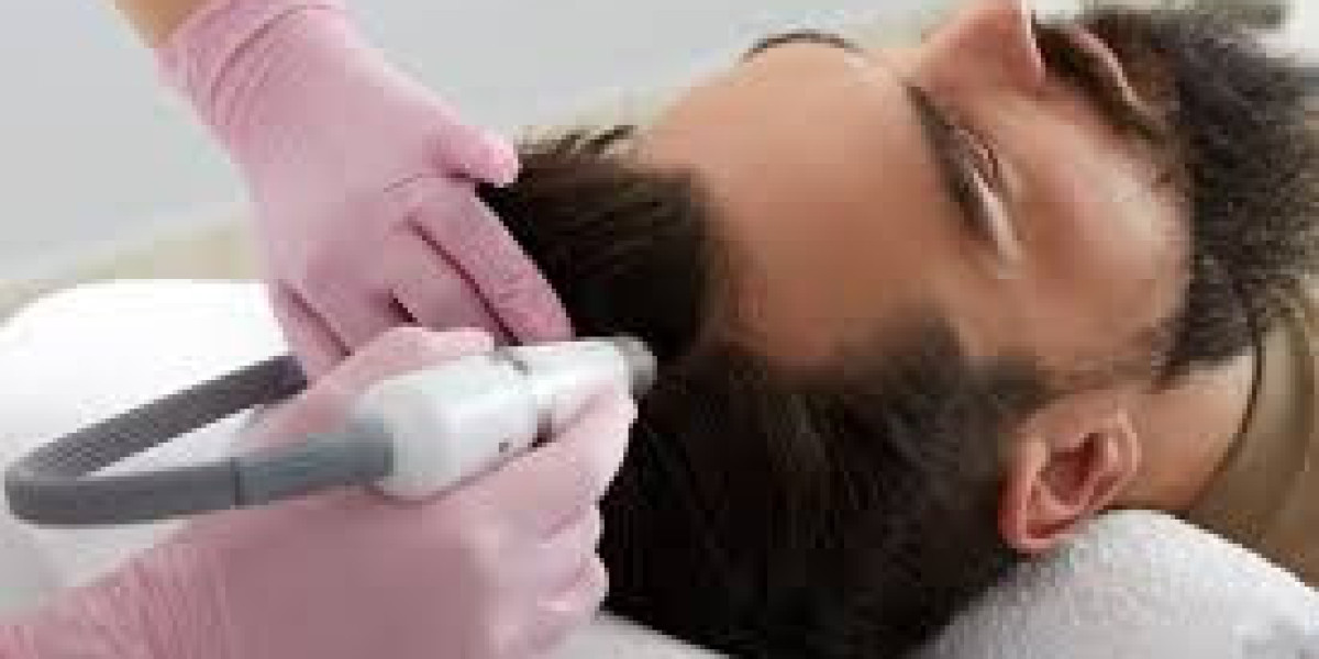 Non Medical Hair Restoration: Safe and Natural Ways to Restore Hair